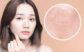 乾燥肌と上手に付き合う【紫月 波留】